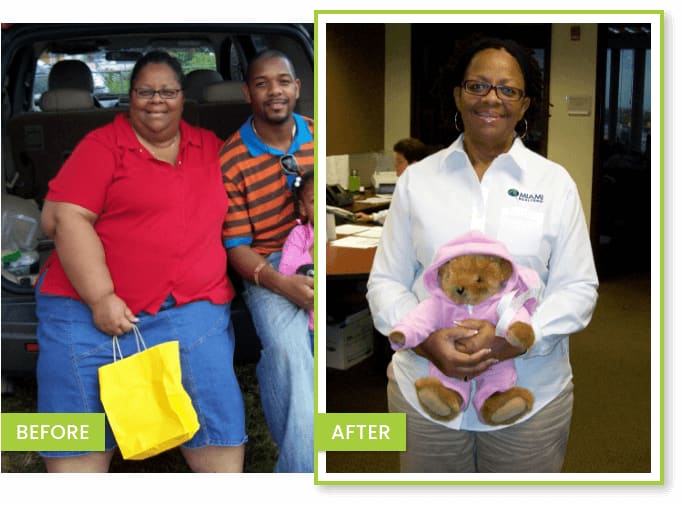 Cheryl, a Fit 4 Life patient, before and after photos